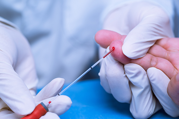 日研发验血技术精准检测早期肠癌，英营养师分享肠道保健法