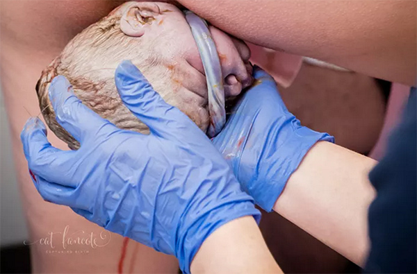 这些美到惊颤的出生照片，把专业摄影师都感动了