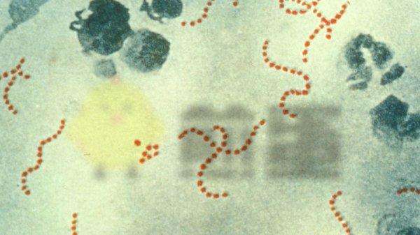 为什么小孩患各种过敏的越来越多？滥用抗生素！