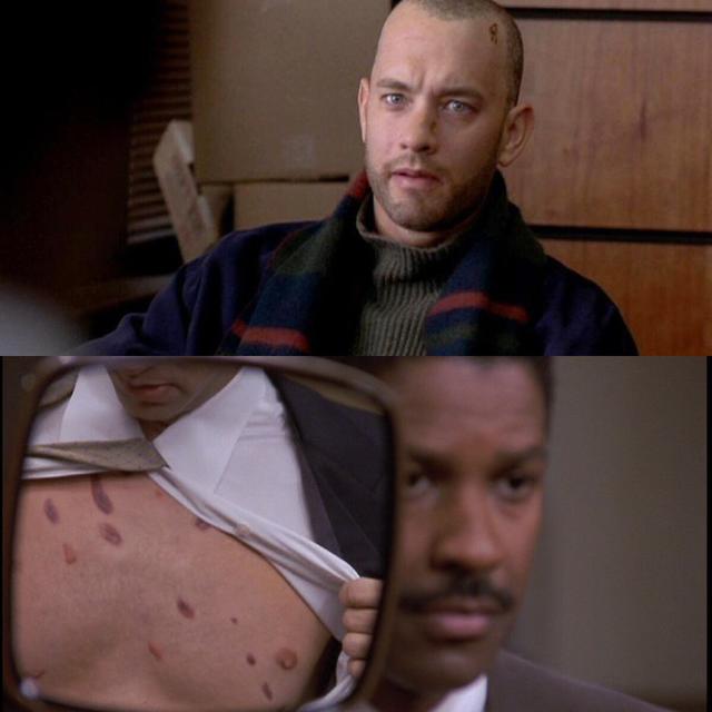 总在反派的皮肤上做文章，你们想过皮肤病患者的感受吗？