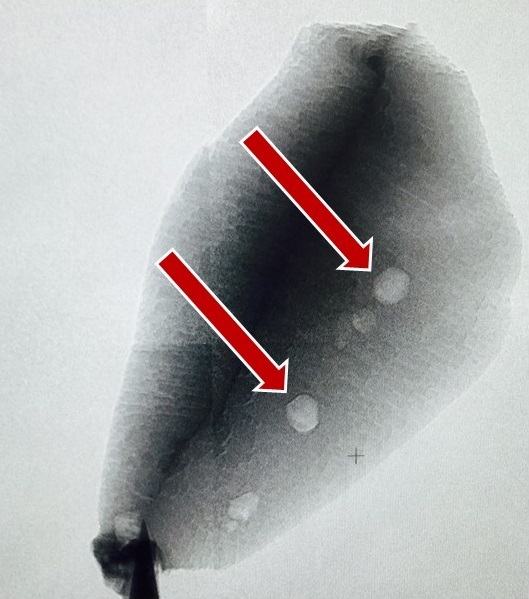 小石头引起的大麻烦