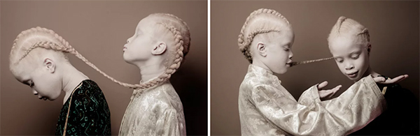 拍摄白化病姐妹花的摄影师：每个人都有自己的独特之美