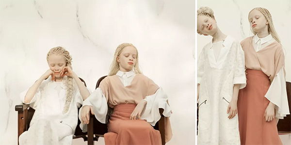 拍摄白化病姐妹花的摄影师：每个人都有自己的独特之美