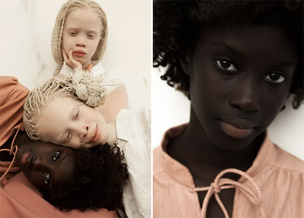 拍摄白化病姐妹花的摄影师：每个人都有自己的独特之美