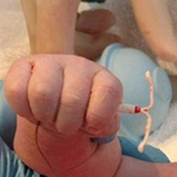 趣看｜波折又顽强，新生儿手握避孕环降临