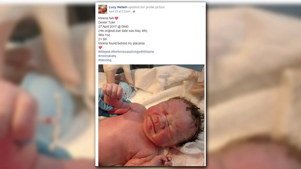 趣看｜波折又顽强，新生儿手握避孕环降临