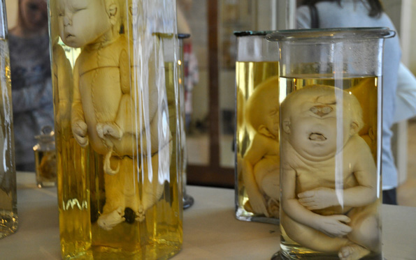 彼得大帝的畸形人博物馆：俄国神学与科学交锋的战场