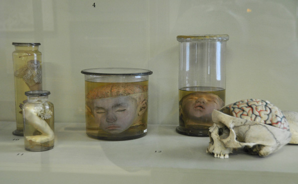 彼得大帝的畸形人博物馆：俄国神学与科学交锋的战场