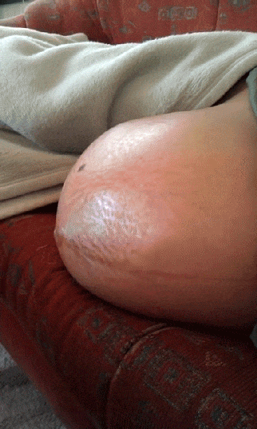 震撼！这些胎动图片你看过吗