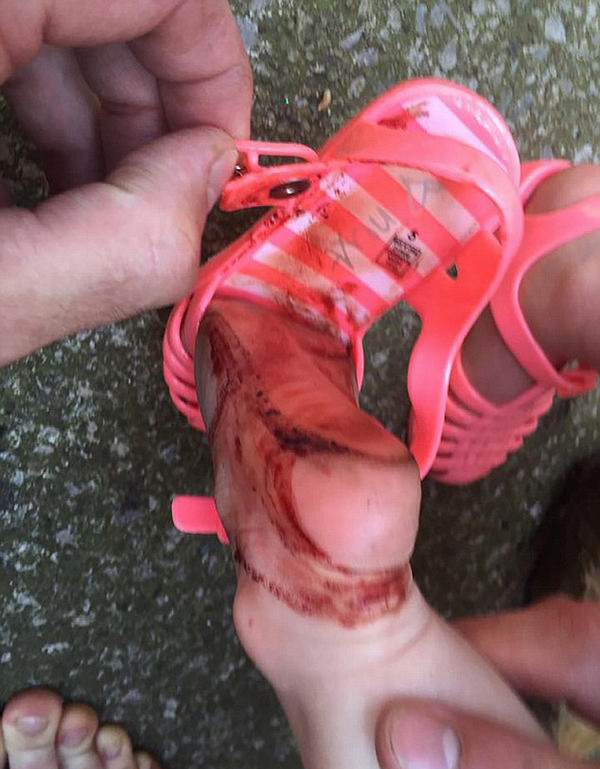 两岁女孩穿NEXT凉鞋半小时满脚血印，家长要求品牌召回