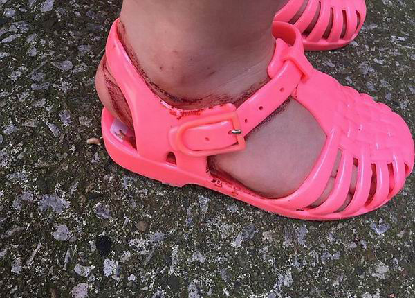 两岁女孩穿NEXT凉鞋半小时满脚血印，家长要求品牌召回