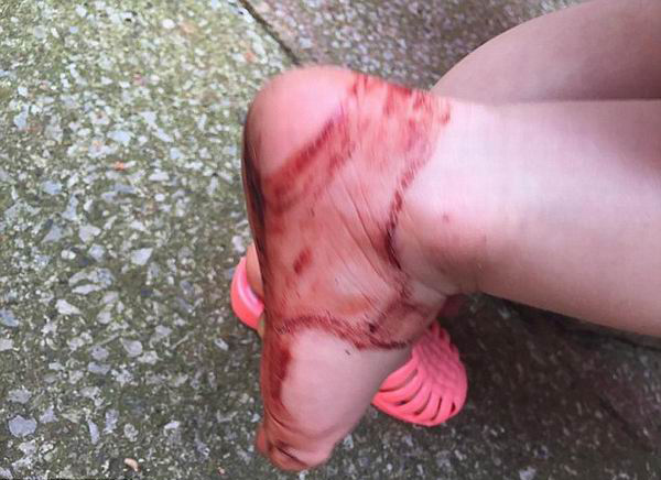 两岁女孩穿NEXT凉鞋半小时满脚血印，家长要求品牌召回