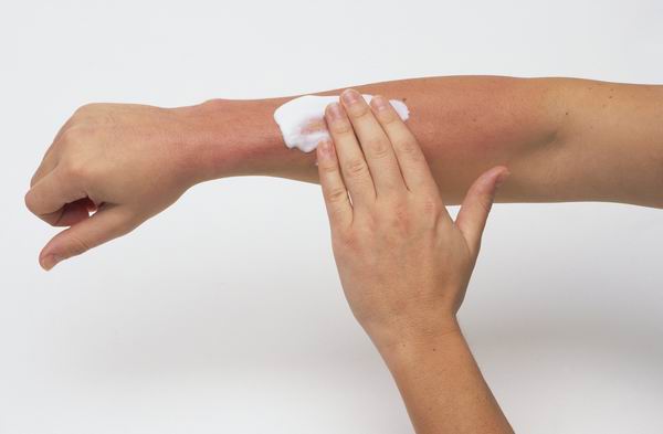 烈日炎炎皮肤易受伤，中医如何防治汗斑痱子和晒伤