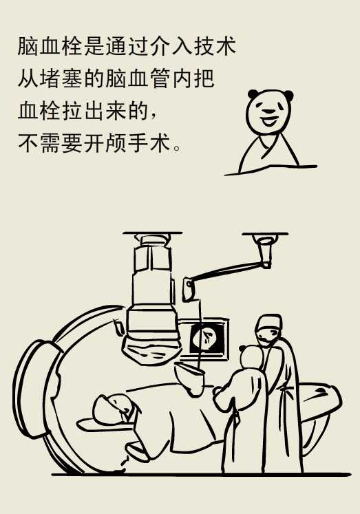 漫画｜脑血栓能取出来？抓紧中风后六小时
