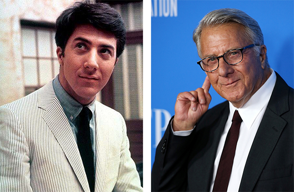 想隆鼻？行，不过你最好想明白一个人有魅力的原因到底是什么