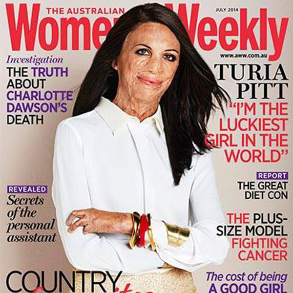 全身65%被烧伤，200多次手术，跑步让她浴火重生