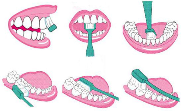 电动VS手动，牙刷到底该怎么选