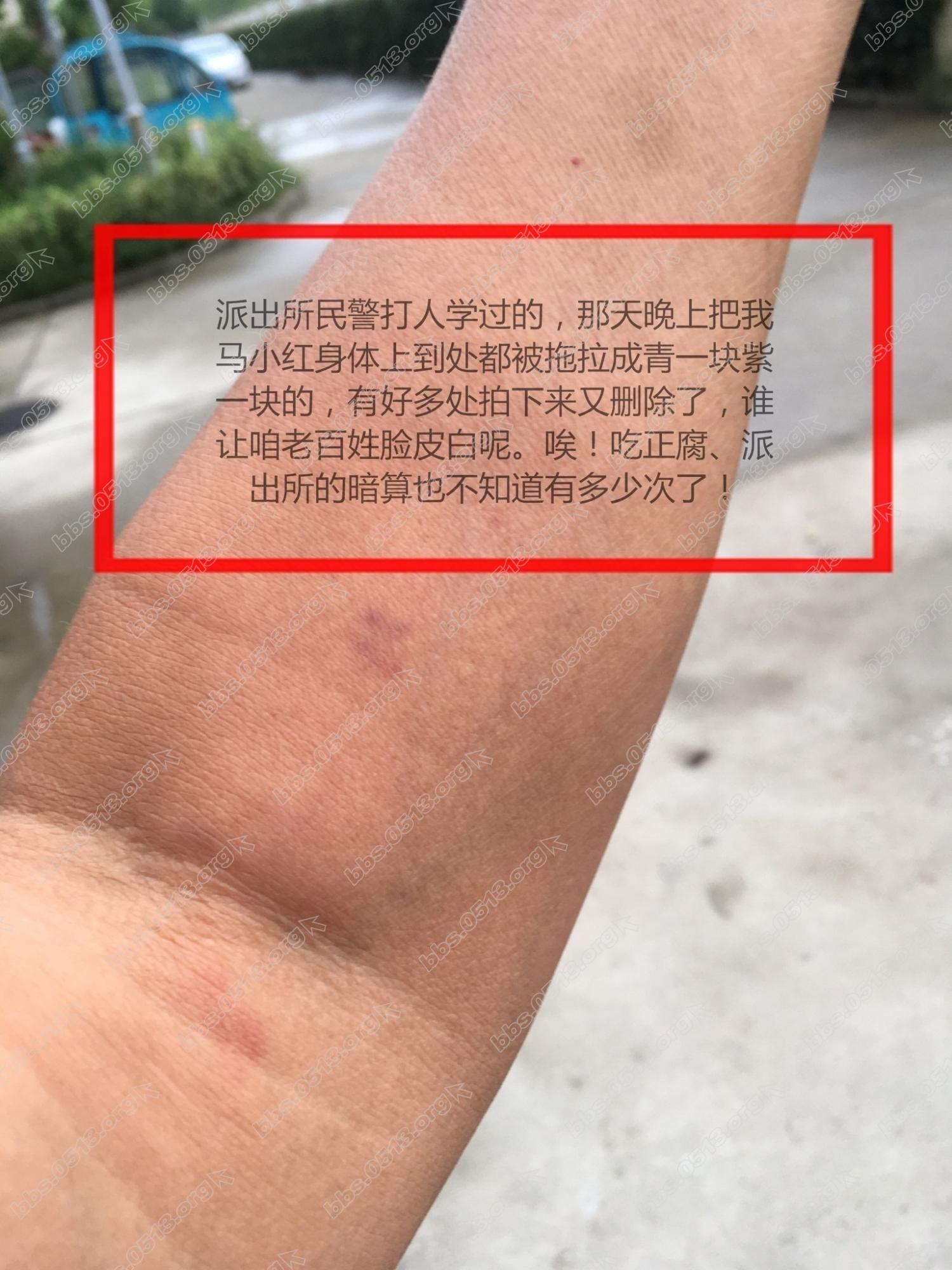 20170814_IMG_1741 (2)_看图王.jpg