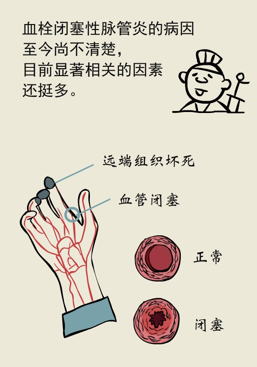 漫画｜太可怕了！抽烟居然会让手指脚趾烂掉......