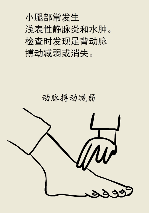 漫画｜太可怕了！抽烟居然会让手指脚趾烂掉......