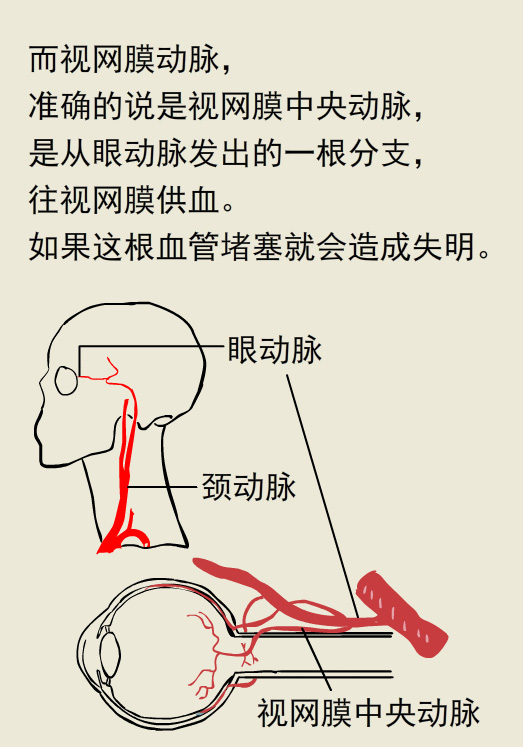 漫画丨玩游戏把眼睛玩瞎了，究竟怎么回事儿？