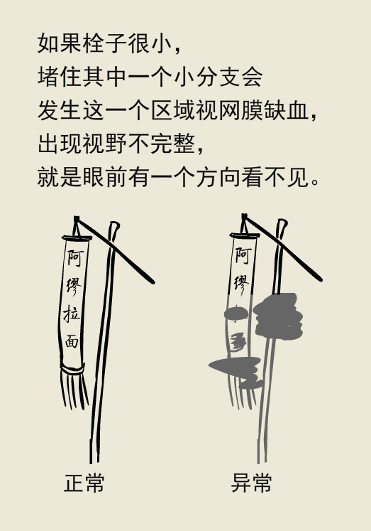 漫画丨玩游戏把眼睛玩瞎了，究竟怎么回事儿？