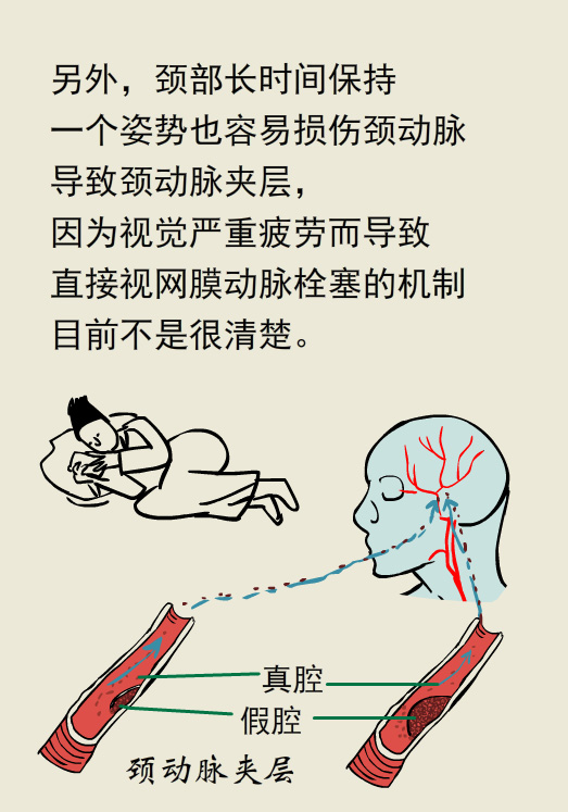 漫画丨玩游戏把眼睛玩瞎了，究竟怎么回事儿？
