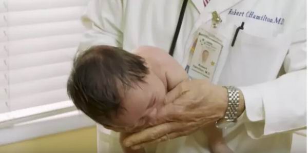 儿科医生教你一招，瞬间止住婴儿哭泣