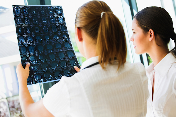 什么样的颈动脉斑块容易脱落？