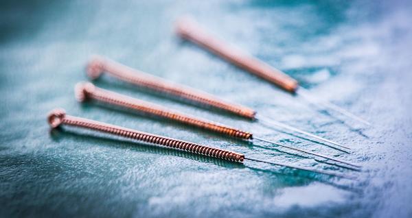 小小银针为什么能减肥？专家：针灸能加速脂肪代谢，抑制食欲