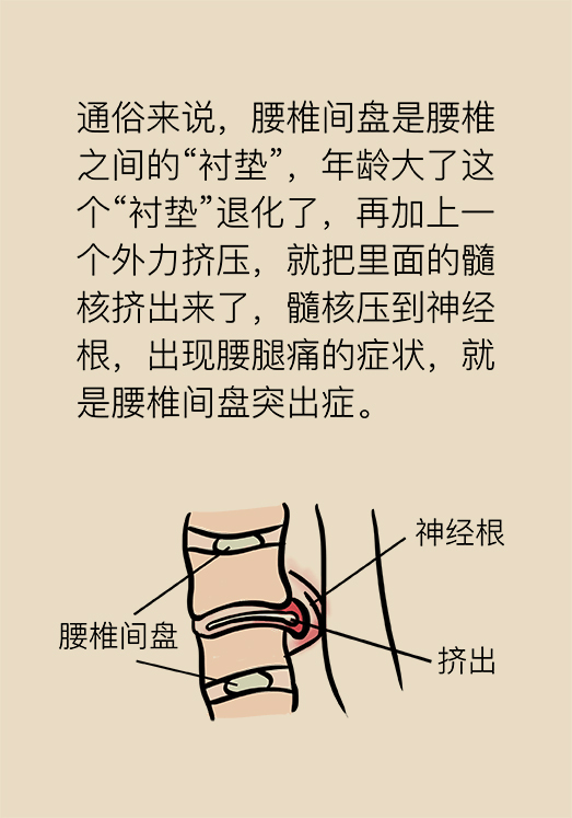 漫画｜“腰椎间盘突出症”咳嗽一声也能诱发，该怎么办？