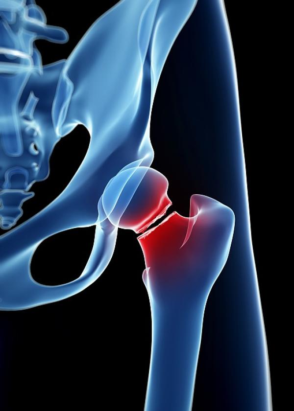 如何解救“人生最后一次骨折”？上海六院闵行骨科联盟启动