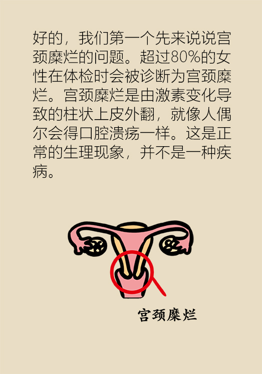 漫画｜姑娘莫慌！这些不叫妇科病