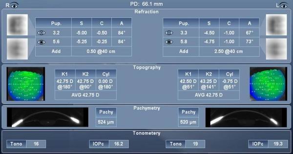 不管是光学眼镜还是太阳镜，这些趋势你都应该了解