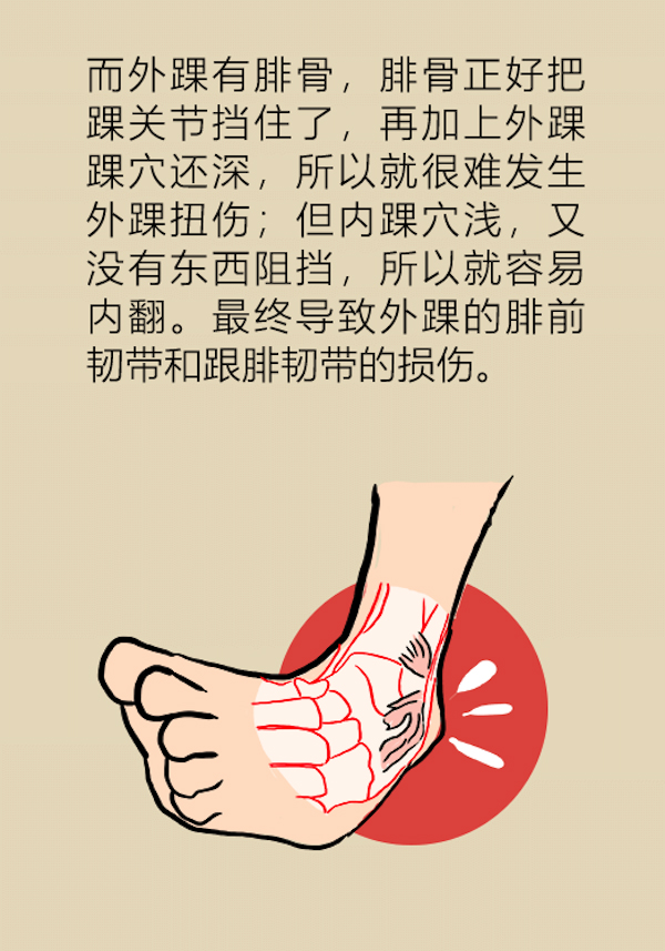 漫画｜孩子崴脚比大人更危险，快提醒粗心的父母们注意！