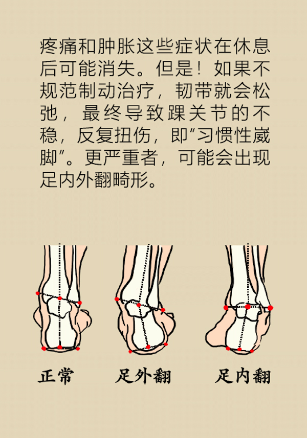 漫画｜孩子崴脚比大人更危险，快提醒粗心的父母们注意！