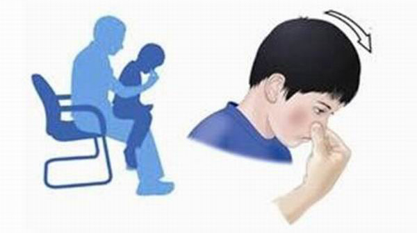 儿童烫伤、划伤、扭伤、流鼻血的急救处理误区