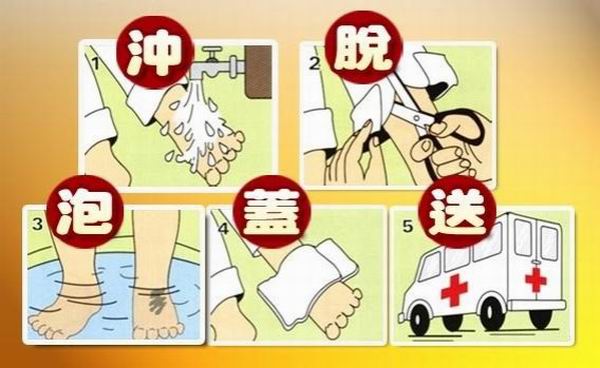 儿童烫伤、划伤、扭伤、流鼻血的急救处理误区