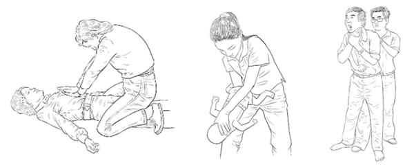 问答｜孩子吃饭被噎怎么办？记住这招救命大法！