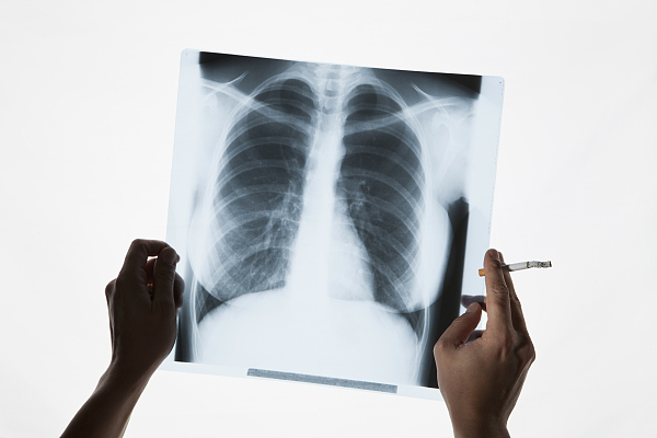 问答｜“老烟枪”出现咳痰喘就要警惕慢阻肺？