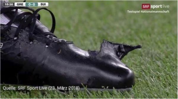 职业球员的脚有多“丑陋”？这才是足球真实的样子