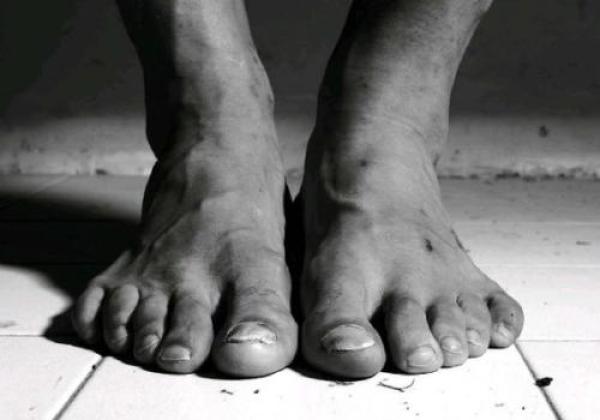 职业球员的脚有多“丑陋”？这才是足球真实的样子