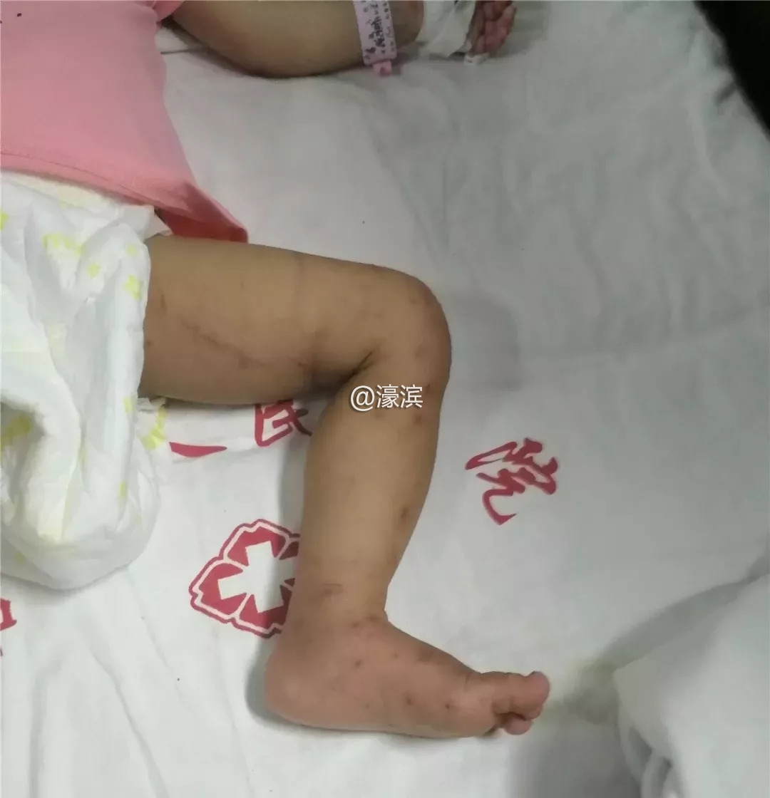 奇迹生还!1岁10个月女童深山走失5天4夜,不吃不喝咋活?