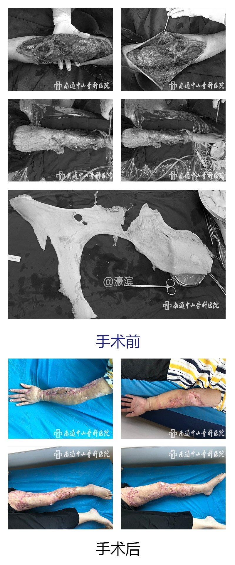 术前术后92 (2).jpg