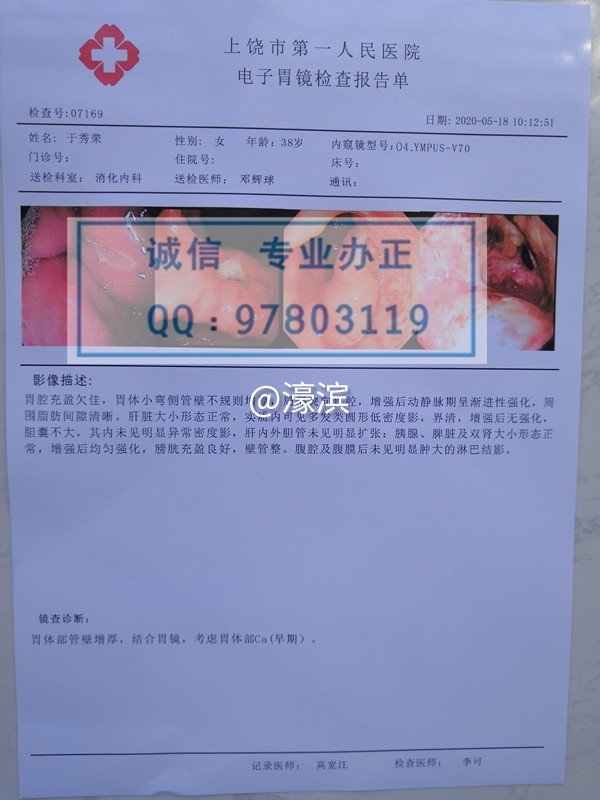 意外怀孕B超单，胃镜检查报告单，人流证明单