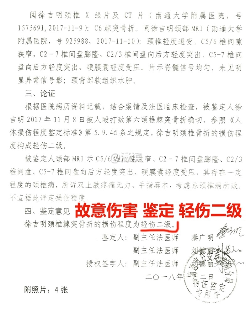 司法鉴定 轻伤二级.jpg