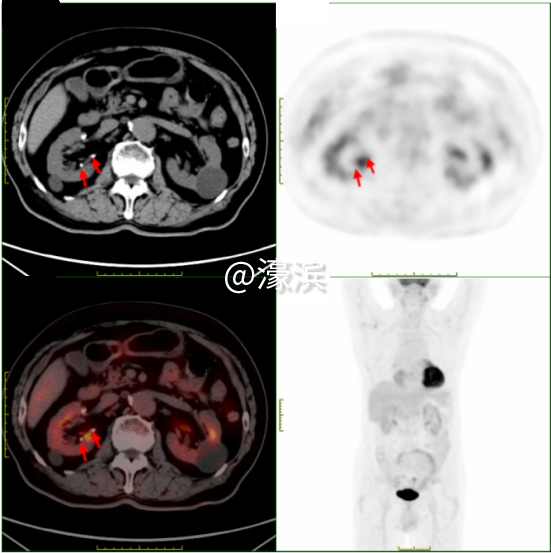 15603779eb823b87b2742c65ffabeb0d.png 图片 5.png