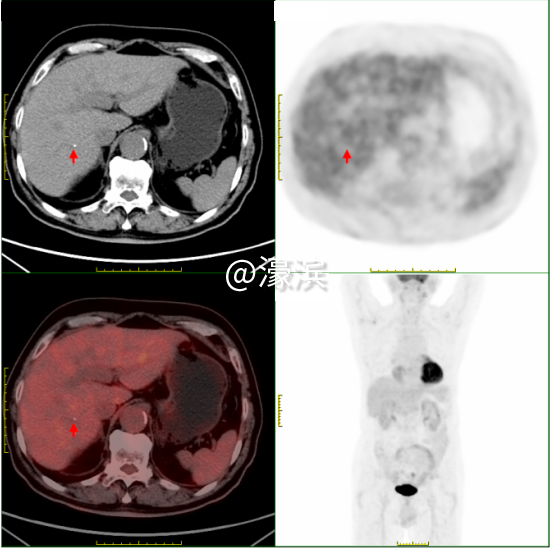 436fe57aaf3db9a0075186ed23b9e20d.png 图片 3.png