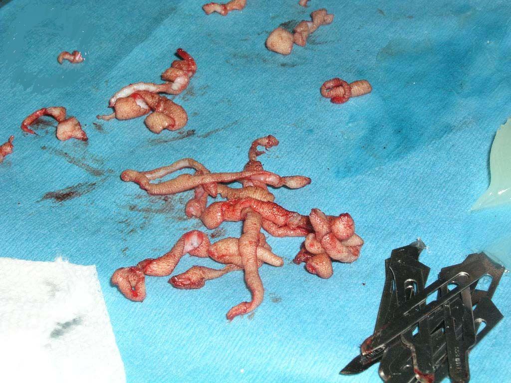 纹身的过程！！有点惹怕！