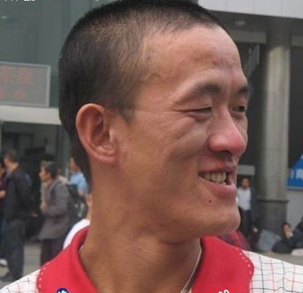 太绝了！奇人自咬鼻子全过程,看的我有点晕~~